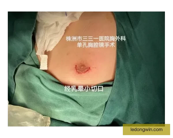 坎宁安气胸康复持续推进 活塞计划一周后复查评估